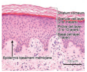 Glycative Stress And Skin Aging 