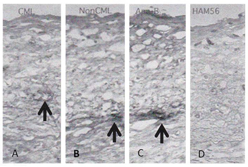 図2.　細胞線維性内膜肥厚部中のAGEs 